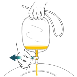 One hand holding top of catheter bag over toilet with other hand pulling valve out to open it and urine flowing from bag into toilet.