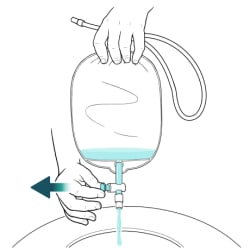 One hand holding top of catheter bag over toilet with other hand pulling out valve to open it and cleaning solution flowing from bag into toilet.