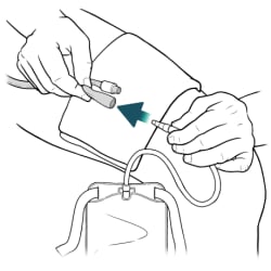 One hand holding catheter and other hand putting leg bag drainage tube into catheter.