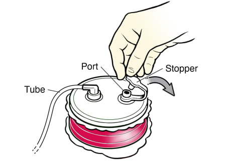 Closeup of gloved hand opening stopper on a full hemovac drain.