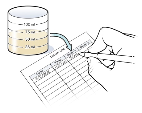 Hand writing fluid measurement information in log.
