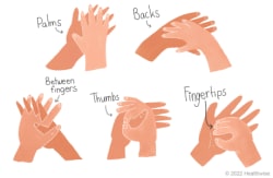 Washing the palms and backs of hands, the thumbs, between fingers, and under fingernails.
